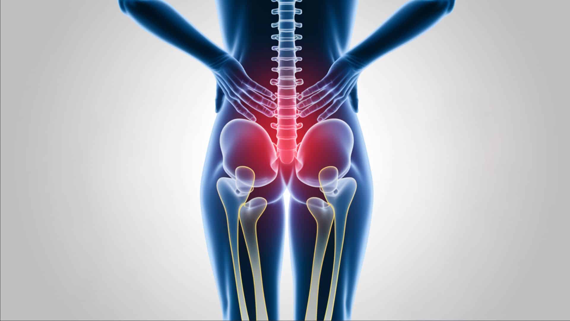 The Thecal Sac Compression Symptoms