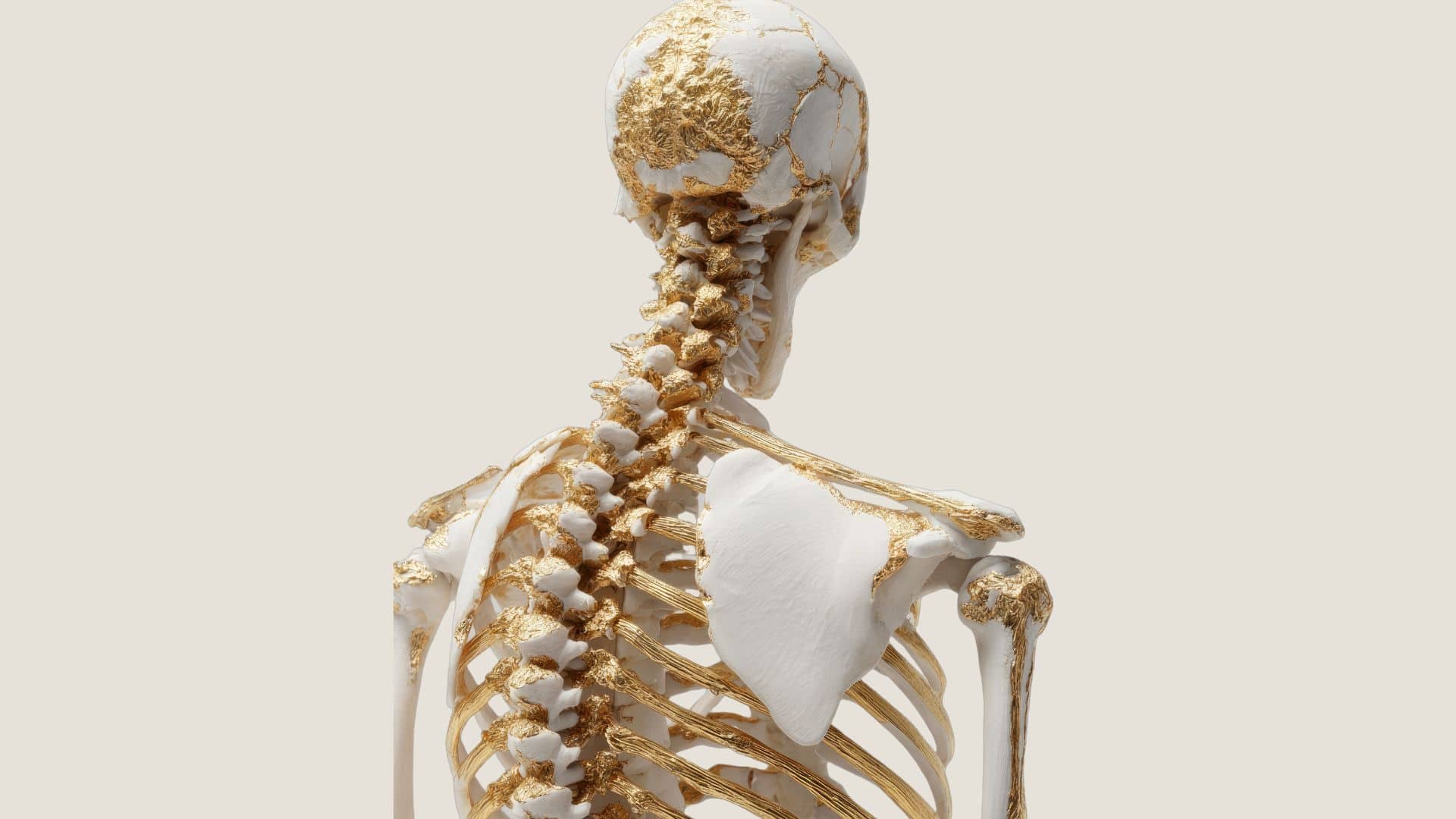 cervical spine thecal sac compression symptoms