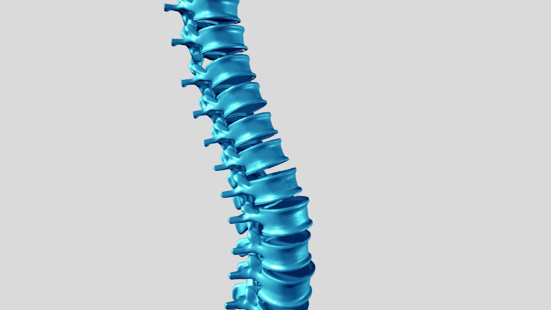 lumbar spine thecal sac compression symptoms