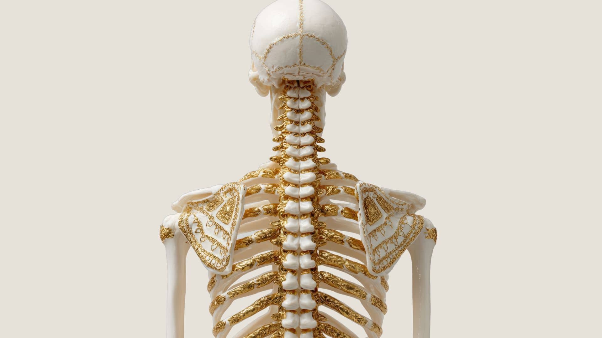 thoracic spine thecal sac compression symptoms