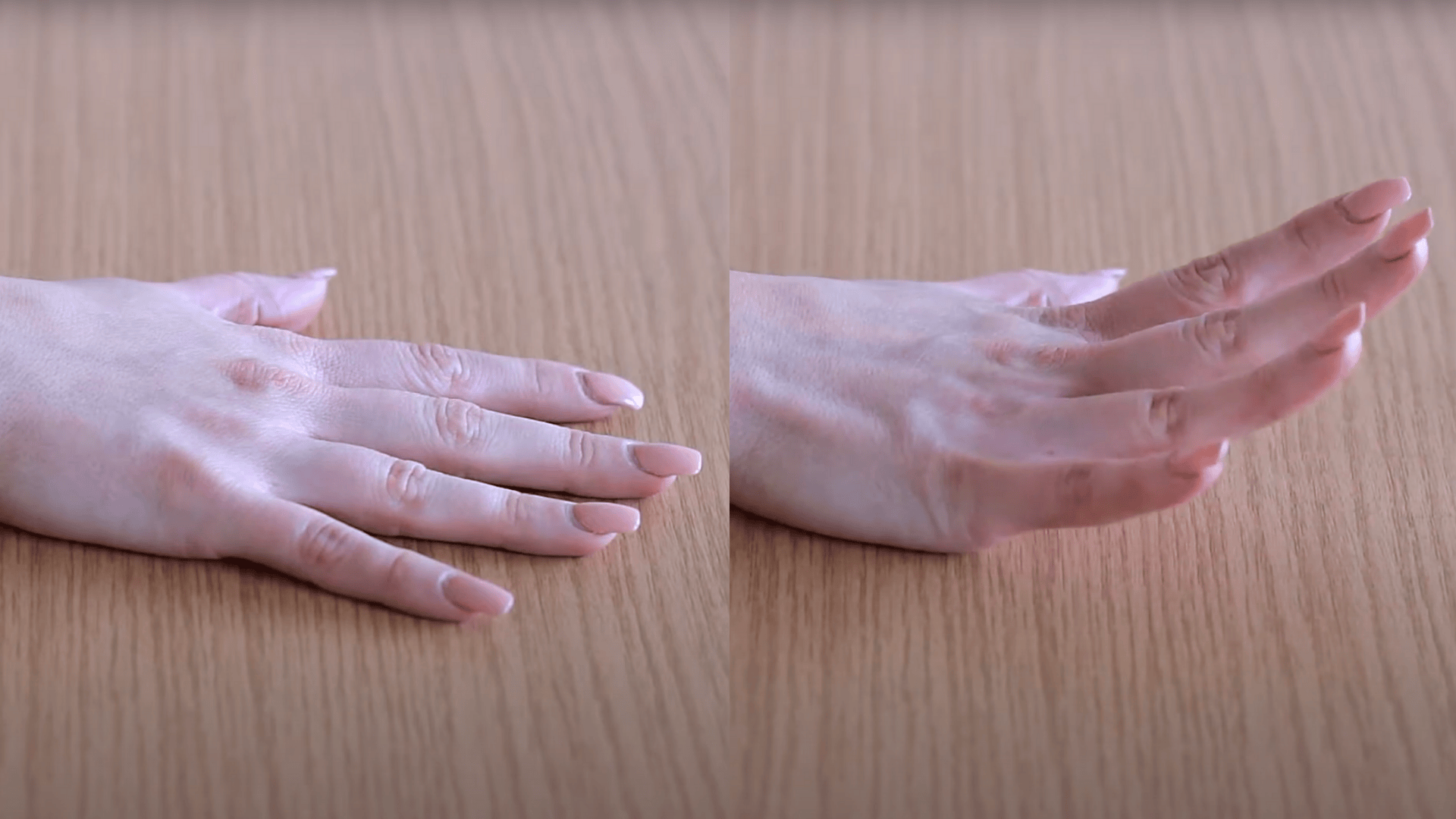 Finger Extension