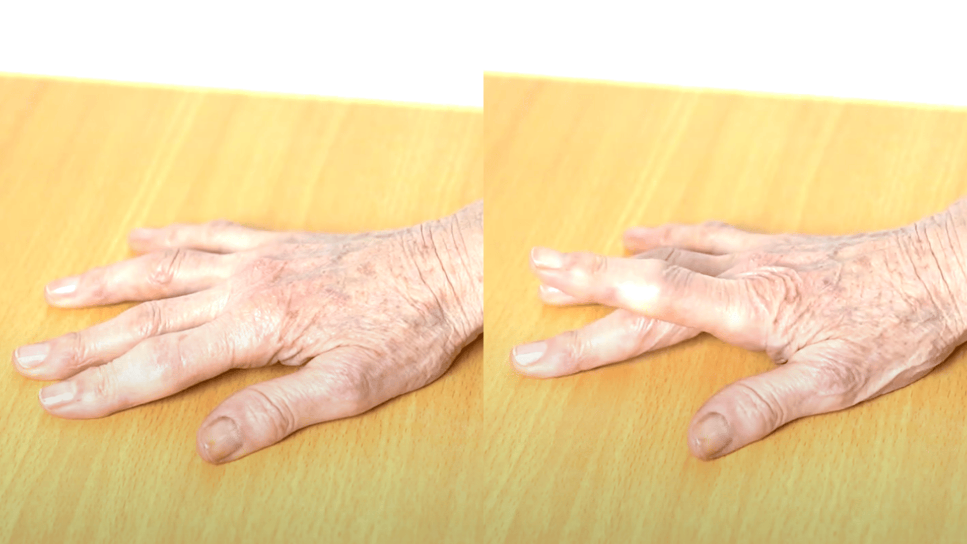 Finger Stretches
