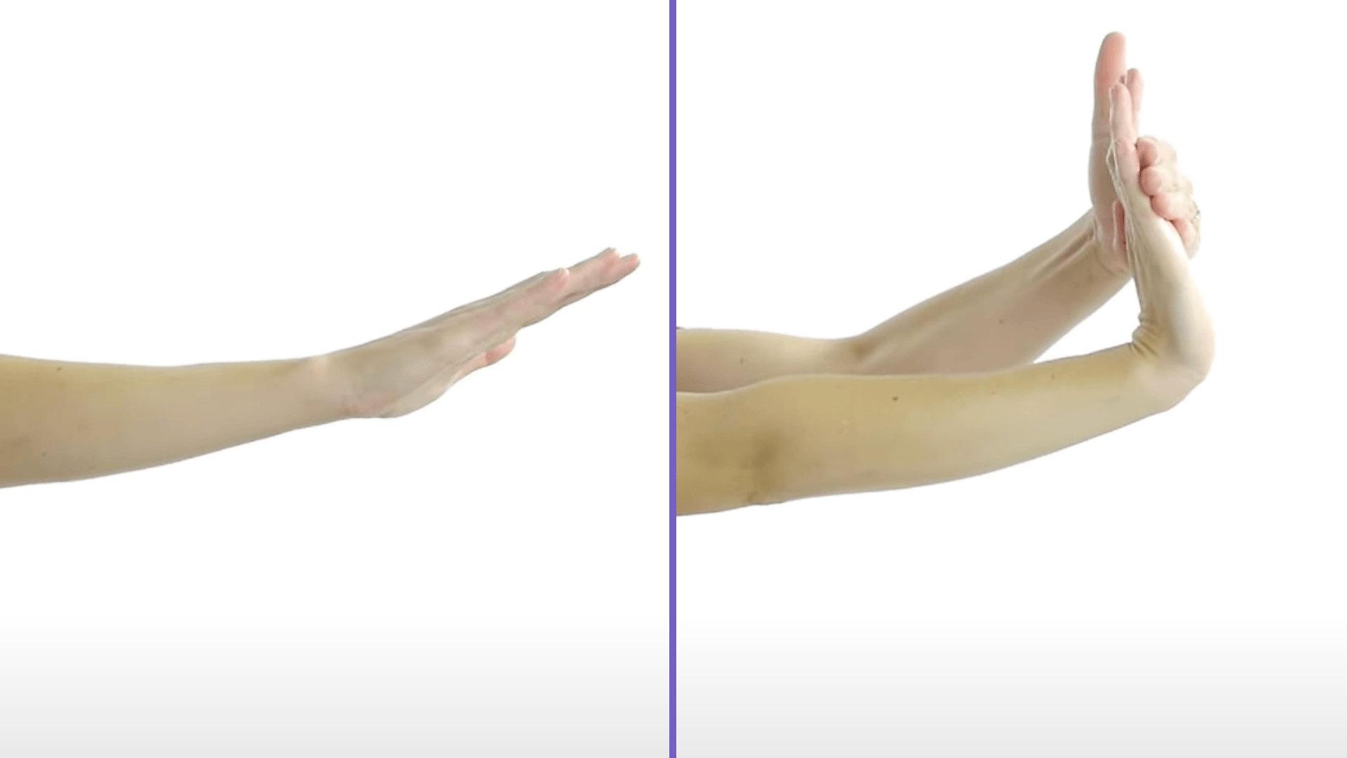Wrist Flexor Stretch
